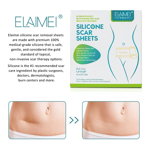 Medical Soft Silicone Gel Tape for Scar Removal