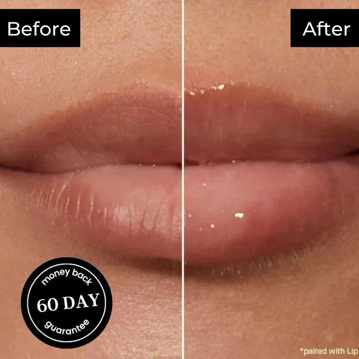 Derol Lip Plumper Set